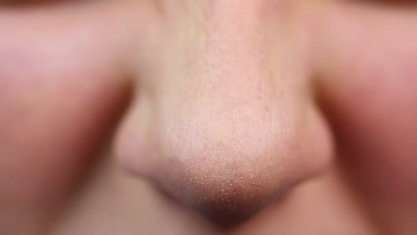 Vue rapprochée du nez, accueil chez le cosmétique. Pores élargis, problèmes de peau — Video