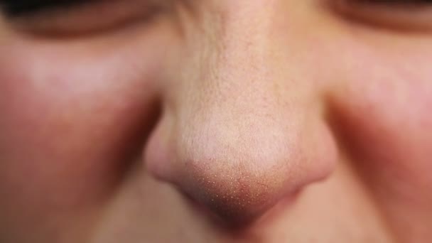 Vidéo en gros plan de la personne qui veut éternuer. Allergies, avoir froid. Soins de santé — Video