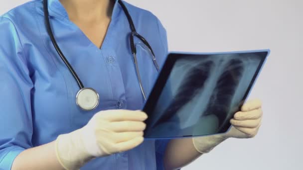 Thérapeute regardant la radiographie pulmonaire et faire un diagnostic, le traitement du patient — Video