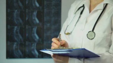 Hastanın X-ray analiz ve tıbbi kayıtları tanıda aşağı yazma cerrah