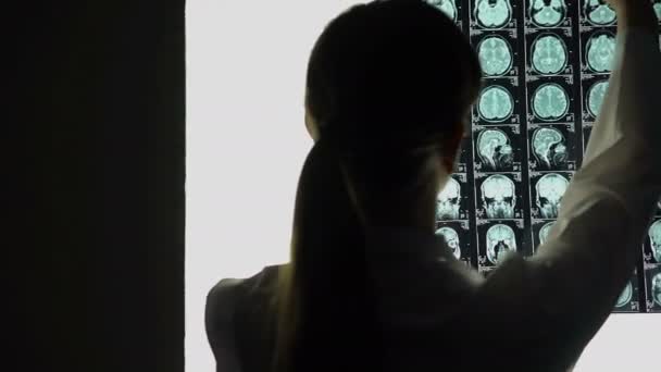 Задумчивая женщина-врач анализирует сканирование мозга, медицинские исследования, трудный случай — стоковое видео
