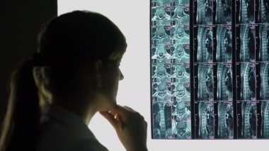 Spinal yaralanma, tanı yapma hastanın x-ray arıyorsunuz doktor nadir bir durum