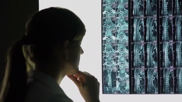 Spinal yaralanma, tanı yapma hastanın x-ray arıyorsunuz doktor nadir bir durum — Stok video