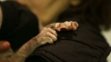 Hasta ince Sphynx kedi veteriner kliniğinde sahibinin elinde oturan, sağlık