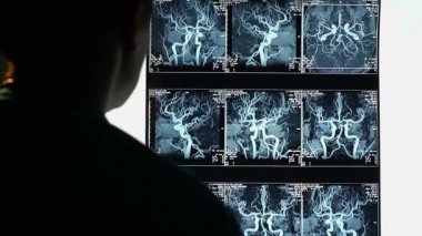 Doktor Röntgen incelenmesi