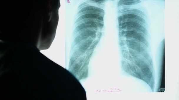 Docteur regardant une image radiographique — Video