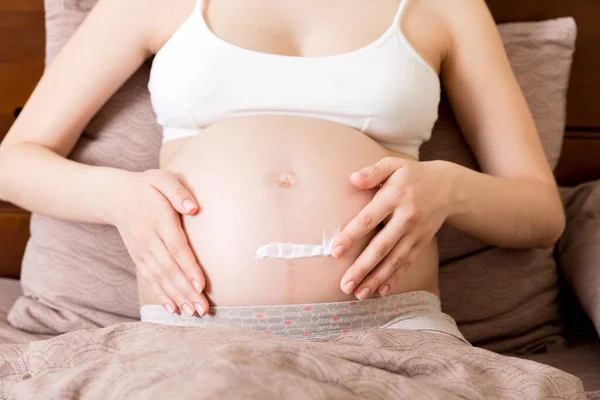 Gravid Flicka Sitter Hemma Sängen Och Smetar Stretch Märke Grädde — Stockfoto