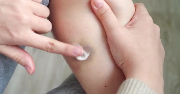 Closeup of hands applying balm to leg. Knee injury, skin hematoma, skin repair concept. slow motion — Stock Video