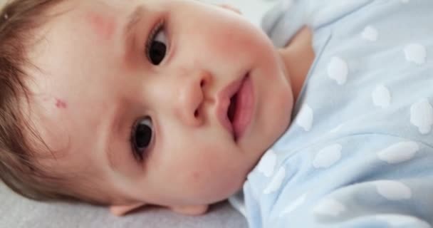 ママはアレルギークリームや他の皮膚病で赤ちゃんの顔を潤滑します。スキンケアの概念。若いです母女性タッチ赤ちゃん顔 — ストック動画
