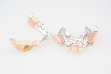 Takma diş üst ve alt plastik ve metal yapılmış