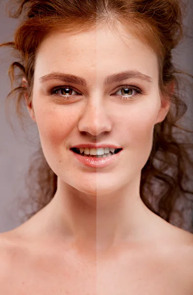 Concept huidverzorging en tanden whitening — Stockfoto