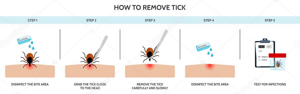 The correct way to remove a tick insect correctly. Prevention of infections transmitted by mite