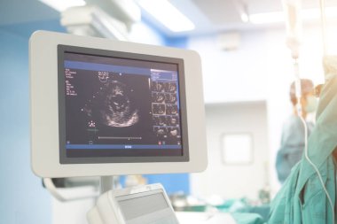 Doktor kalp hastasını ekokardiyogramla teşhis için inceliyor ya da semptomları açıklıyor. Tıbbi muayene, ultrason. Tıbbi ekipman.