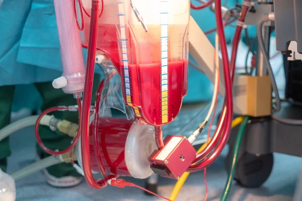 Hartlongmachine Voor Hartchirurgie Operatiekamer Rolpompen Van Hartlongmachine Voor Cardiopulmonale Bypass — Stockfoto