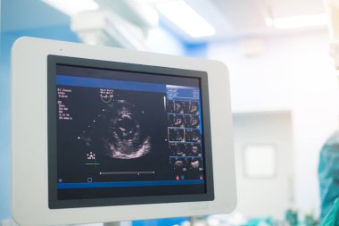 Doktor kalp hastasını ekokardiyogramla teşhis için inceliyor ya da semptomları açıklıyor. Tıbbi muayene, ultrason. Tıbbi ekipman.