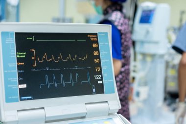EKG monitörü aort içi balon pompa makinesinde. Tıbbi ekipman.