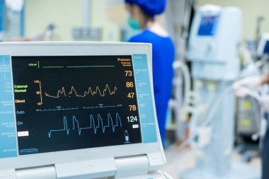 EKG monitörü aort içi balon pompa makinesinde. Tıbbi ekipman.