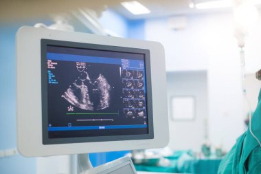Doktor kalp hastasını ekokardiyogramla teşhis için inceliyor ya da semptomları açıklıyor. Tıbbi muayene, ultrason. Tıbbi ekipman.