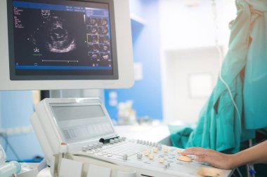 Doktor kalp hastasını ekokardiyogramla teşhis için inceliyor ya da semptomları açıklıyor. Tıbbi muayene, ultrason. Tıbbi ekipman.