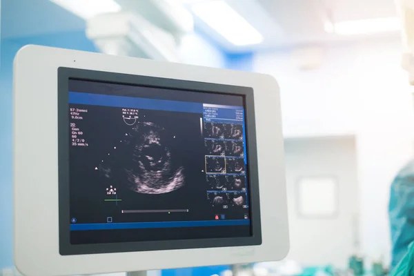 Arts Onderzoekt Patiënt Van Het Hart Door Echocardiogram Voor Diagnose — Stockfoto