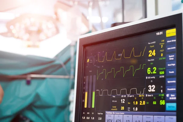 Electrocardiograma Cirugía Hospitalaria Sala Urgencias Que Muestra Frecuencia Cardíaca Del — Foto de Stock