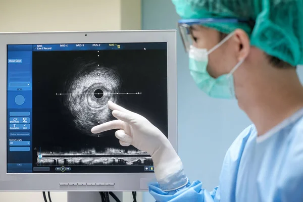 Doktor Steril Üniforma Giyer Kalp Kateterizasyon Laboratuvarında Intravasküler Ultrason Görüntüleme — Stok fotoğraf