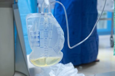 İdrar torbası tıbbi tedavi drenaj mesane lastik esnek vücut enfeksiyonu bakteri ölçümü tuvalet bacağı rahatlama kanser aleti kalkülüs vesik problem anatomi steril cerrahi üretra.