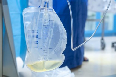 İdrar torbası tıbbi tedavi drenaj mesane lastik esnek vücut enfeksiyonu bakteri ölçümü tuvalet bacağı rahatlama kanser aleti kalkülüs vesik problem anatomi steril cerrahi üretra.