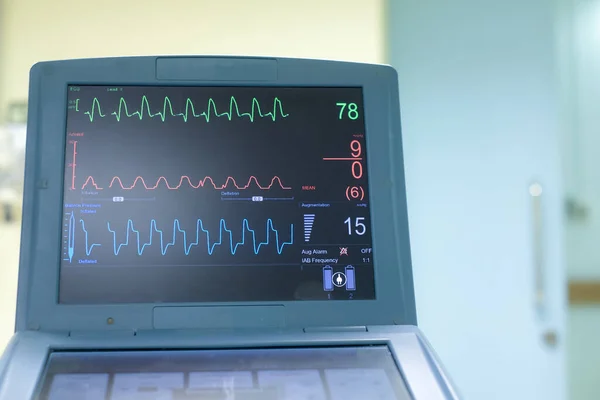 Monitor Ekg Máquina Bomba Globo Intraaórtico Equipos Médicos — Foto de Stock