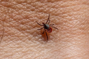 Castor fasulyesi kenesi (Ixodes ricinus)