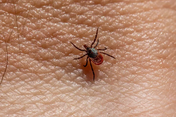 Castor fasulyesi kenesi (Ixodes ricinus)