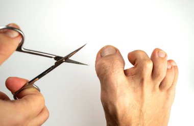 Adam ayak tırnaklarını makasla kesiyor.