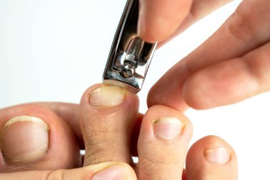 Adam ayak tırnaklarını makasla kesiyor.