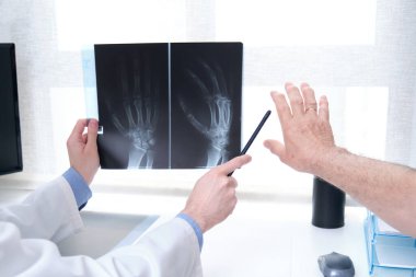 Genç bir doktor, kıdemli bir hastanın eklem iltihabının röntgenini inceliyor. Bir elin radyografisi.