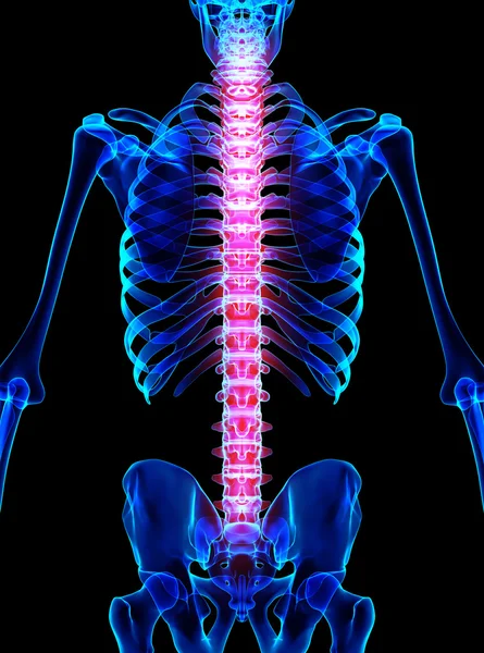 Spine painful skeleton x-ray, 3D illustration. — Stock Photo, Image