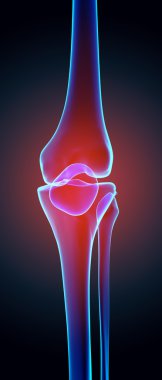 Diz acı - iskelet x-ray.