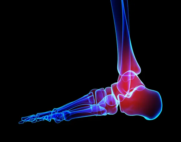 Dolor en el tobillo: radiografía de esqueleto . — Foto de Stock