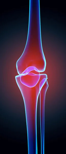 Dolor de rodilla: radiografía de esqueleto . —  Fotos de Stock