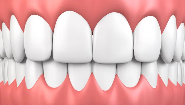 3D illustration teeth and gum model. — Stock Photo, Image