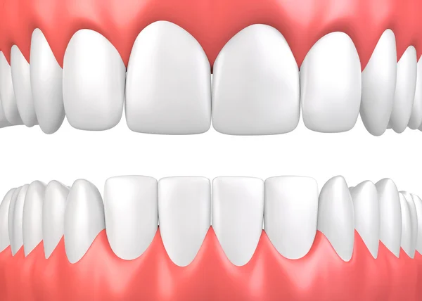 3d 插图的牙齿和牙龈模型. — 图库照片