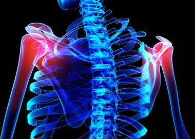 Omuz acı iskelet x-ray, 3d çizim.