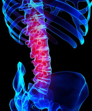 Omurganın ağrılı iskelet x-ray, 3d çizim.