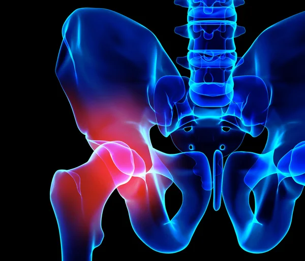 Kalça acı iskelet x-ray, 3d çizim.