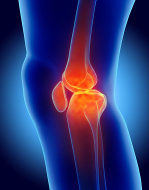 Diz acı - iskelet x-ray.