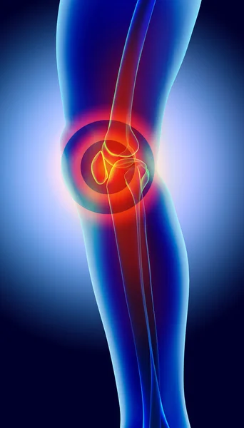 Dolor de rodilla: radiografía de esqueleto . —  Fotos de Stock