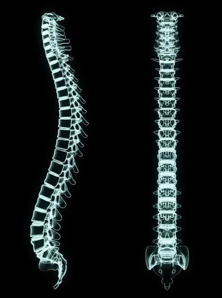 X-Ray wervelkolom voorzijde en kant — Stockfoto