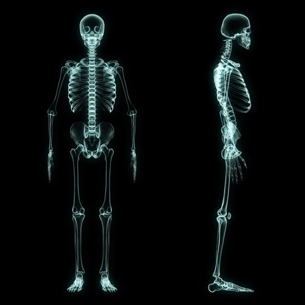 Röntgen des ganzen Skeletts — Stockfoto