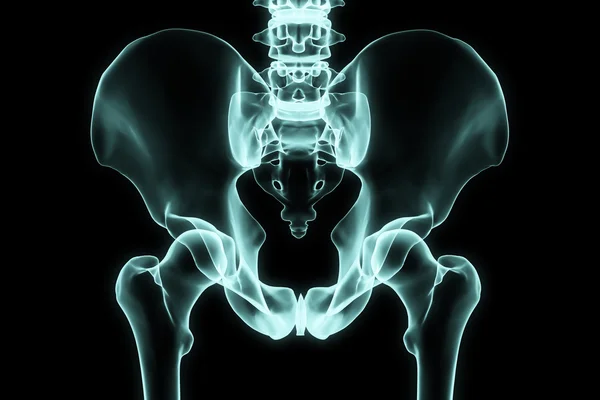 Cadera de rayos X — Foto de Stock