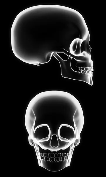 X-ray schedel — Stockfoto