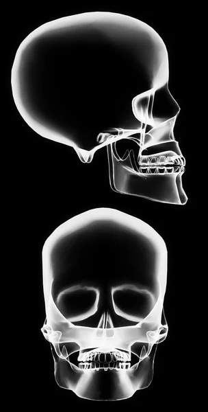 Crânio de raios-x — Fotografia de Stock